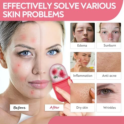Revitalize Your Skin: AURUZA Ice Roller & Gua Sha Set